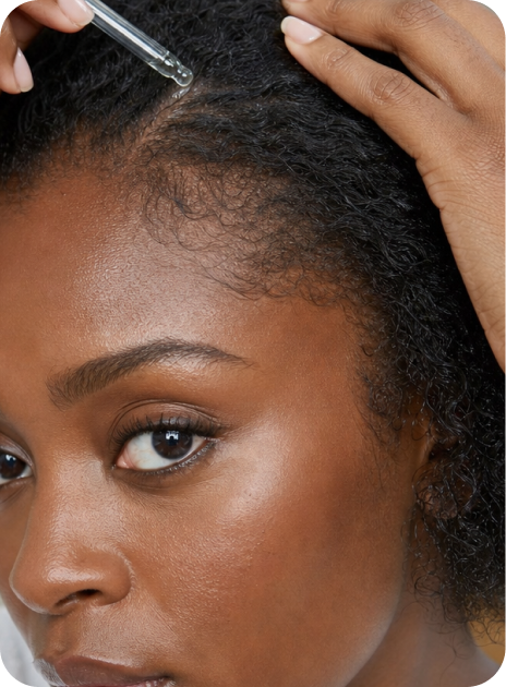 Hair loss and scalp