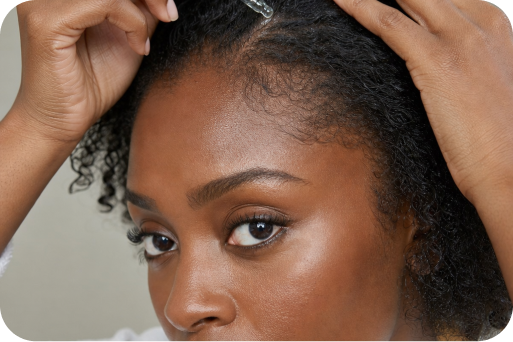Hair loss